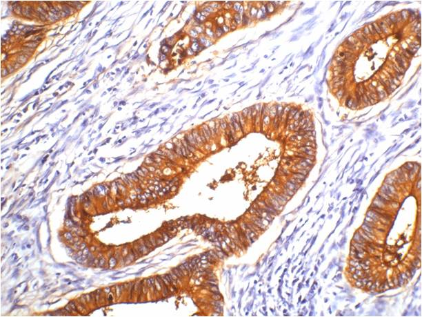 Carcinoembryonic Antigen/CEA Mouse mAb