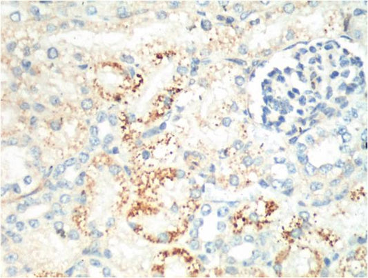 Ki 67 Mouse mAb