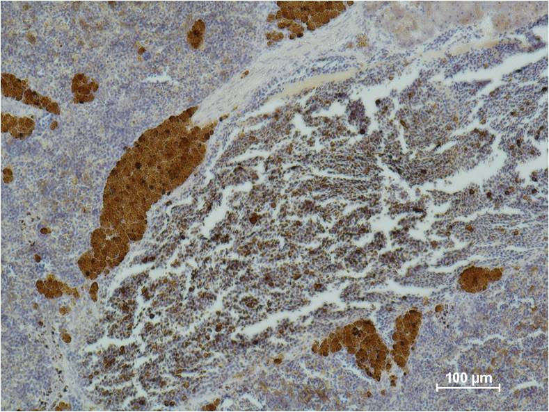 CD25  Mouse mAb