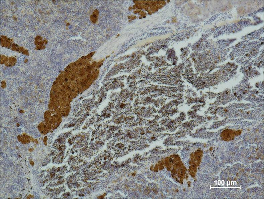 CD25  Mouse mAb