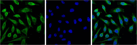 Progesterone Receptor Mouse mAb
