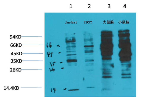 Phosphotyrosine Mouse mAb