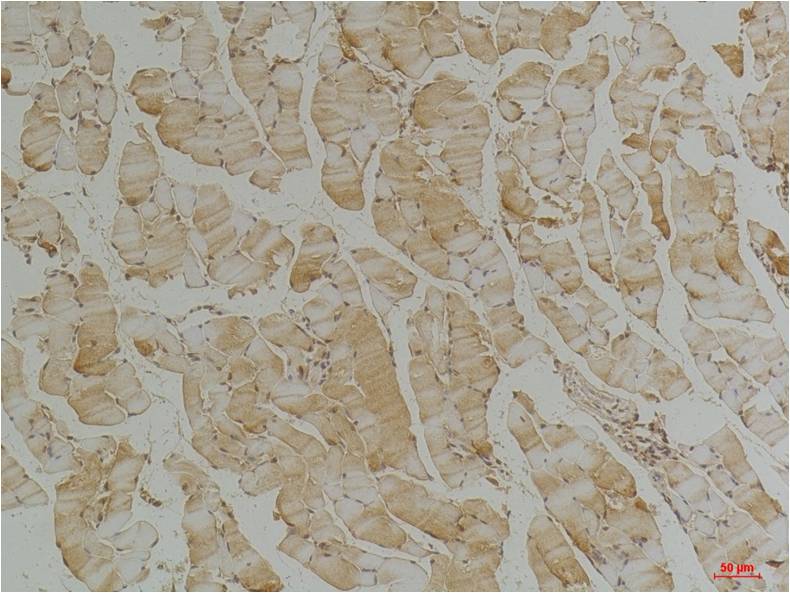 Desmin Mouse mAb