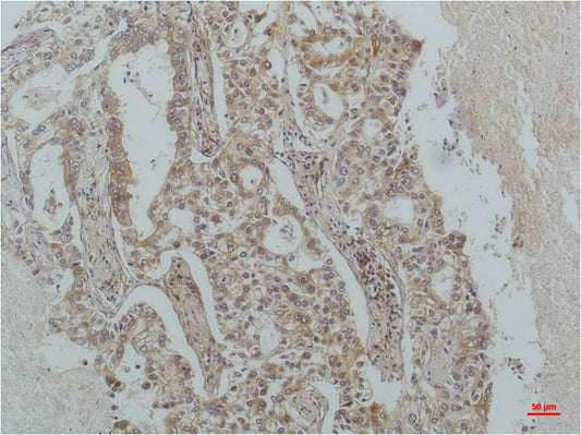 IκB β Mouse mAb