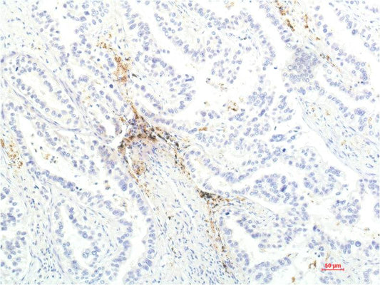 JAK1 (7G6) Mouse mAb