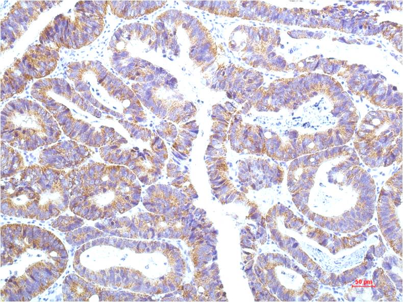 STAT1 (12E8) Mouse mAb