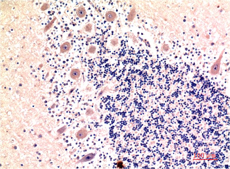LC3B (9H5) Mouse mAb