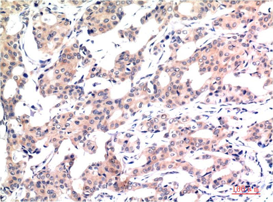 Acetyl-Histone H3 (K9) (2E7) Mouse mAb