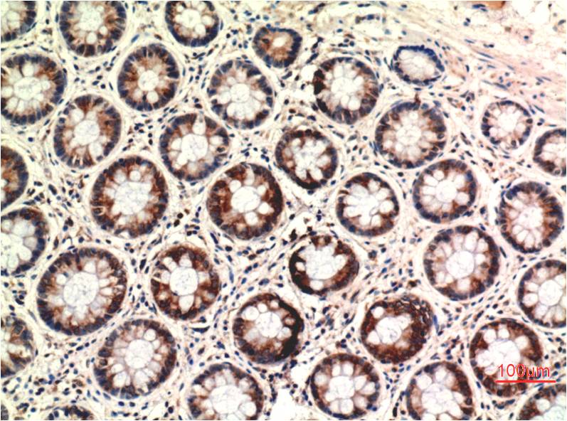 PTEN (2C10) Mouse mAb