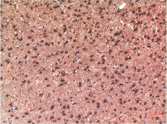 Tau (10E3) Mouse mAb