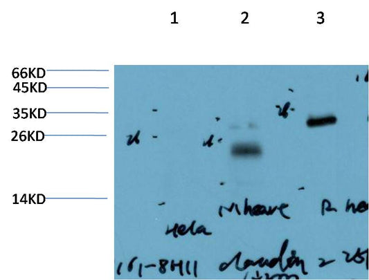 Claudin-2 (8H11) Mouse mAb