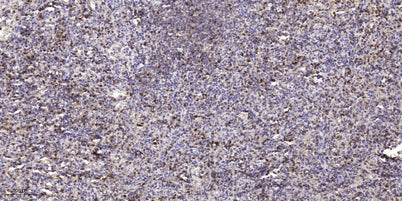 ASPM rabbit pAb