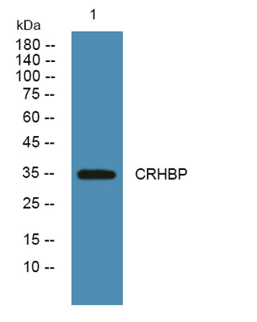 CRHBP rabbit pAb