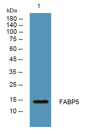 FABP5 rabbit pAb