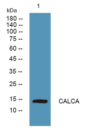 CALCA rabbit pAb