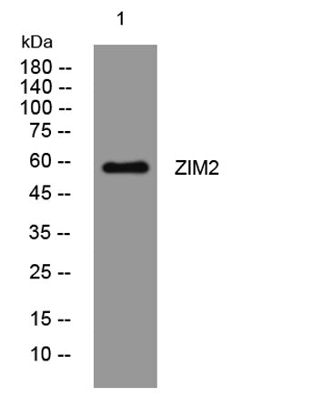 ZIM2 rabbit pAb