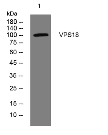 VPS18 rabbit pAb