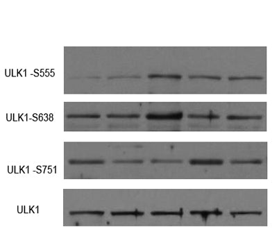 ULK1 (phospho-Ser638)  rabbit pAb