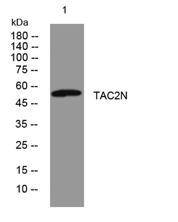 TAC2N rabbit pAb