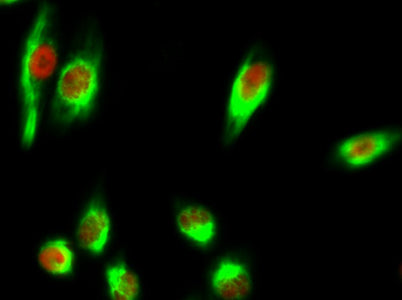 Chk2 (phospho Thr68) rabbit pAb