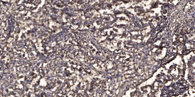 SLP-76 (phospho-Ser376)  rabbit pAb