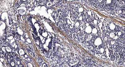 REPS1 (phospho-Ser709)  rabbit pAb