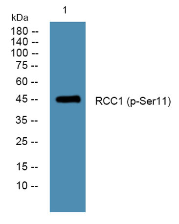 RCC1 (phospho-Ser11)  rabbit pAb