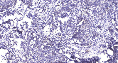 Rb (phospho-Ser807/811)  rabbit pAb