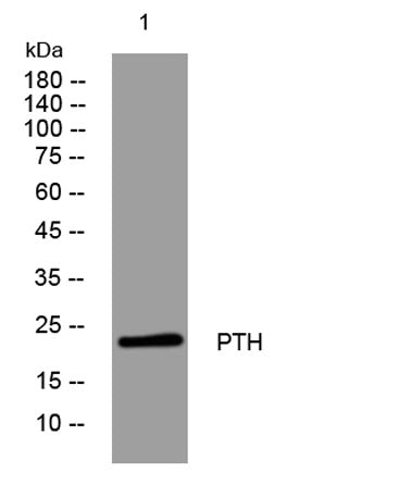 PTH rabbit pAb