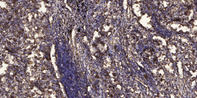 PSD95 (phospho-Ser295)  rabbit pAb