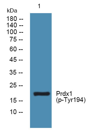 Prdx1 (phospho-Tyr194)  rabbit pAb