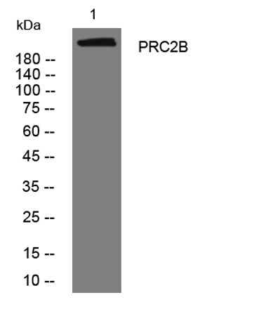 PRC2B rabbit pAb