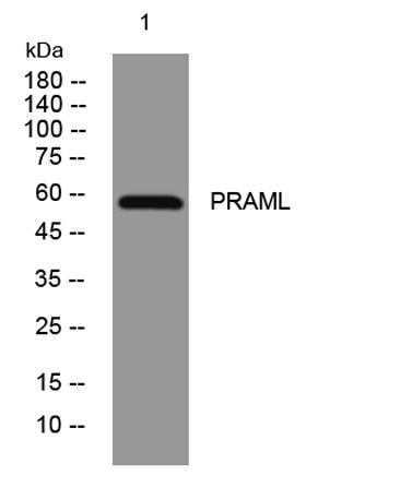 PRAML rabbit pAb