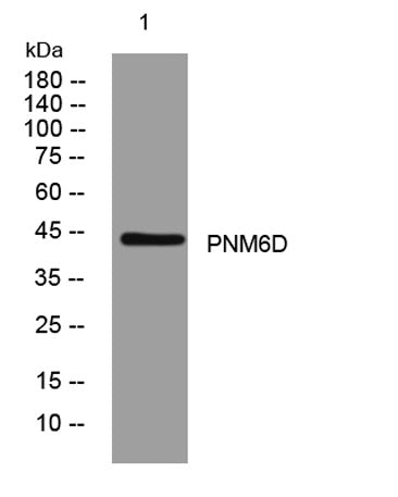 PNM6D rabbit pAb