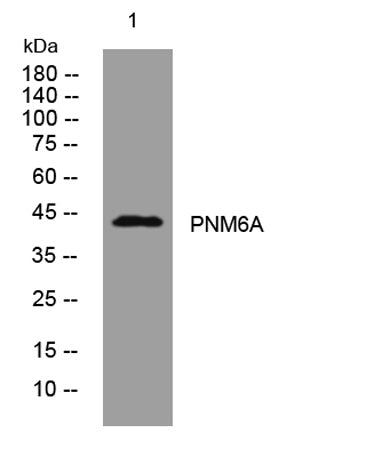 PNM6A rabbit pAb
