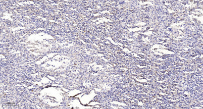 PKCδ (phospho-Ser359)  rabbit pAb