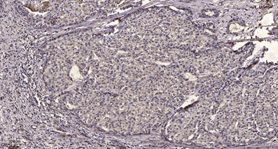 PDGF Receptor β (phospho-Tyr1009)  rabbit pAb