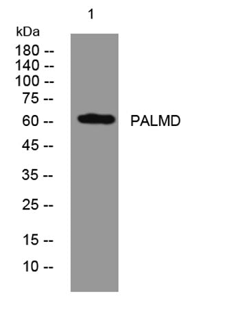 PALMD rabbit pAb