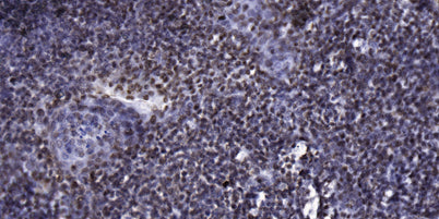 p70 S6 Kinase (phospho-Thr389)  rabbit pAb