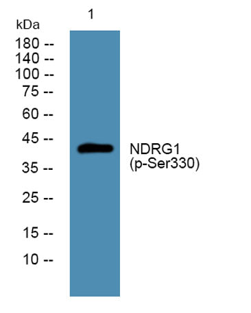 NDRG1 (phospho-Ser330)  rabbit pAb