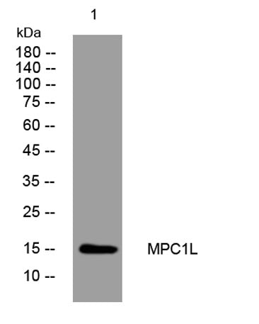 MPC1L rabbit pAb