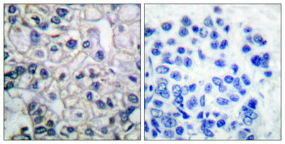 IGF-IR (phospho Tyr1161) rabbit pAb