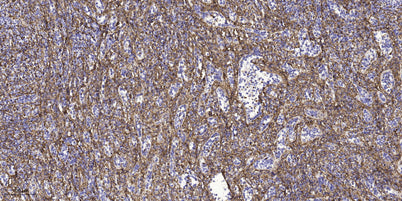 LCE3E rabbit pAb