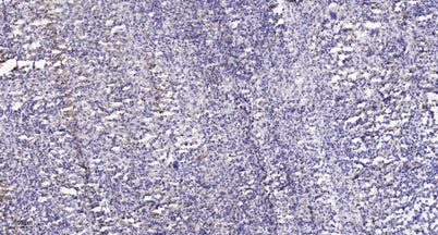 LATS1 (phospho-Thr1079)  rabbit pAb
