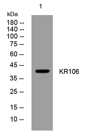 KR106 rabbit pAb