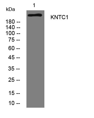 KNTC1 rabbit pAb