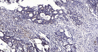 Keratin 20 (phospho-Ser13)  rabbit pAb