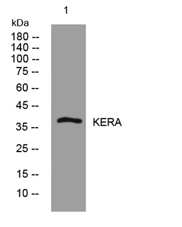 KERA rabbit pAb