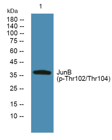 JunB (phospho-Thr102/Thr104)  rabbit pAb