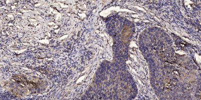 Jak3 (phospho-Tyr980/981)  rabbit pAb
